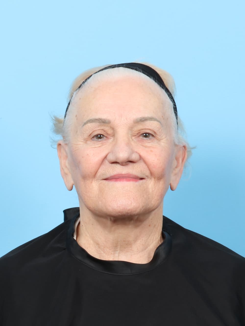 Facelift case #8177 before
