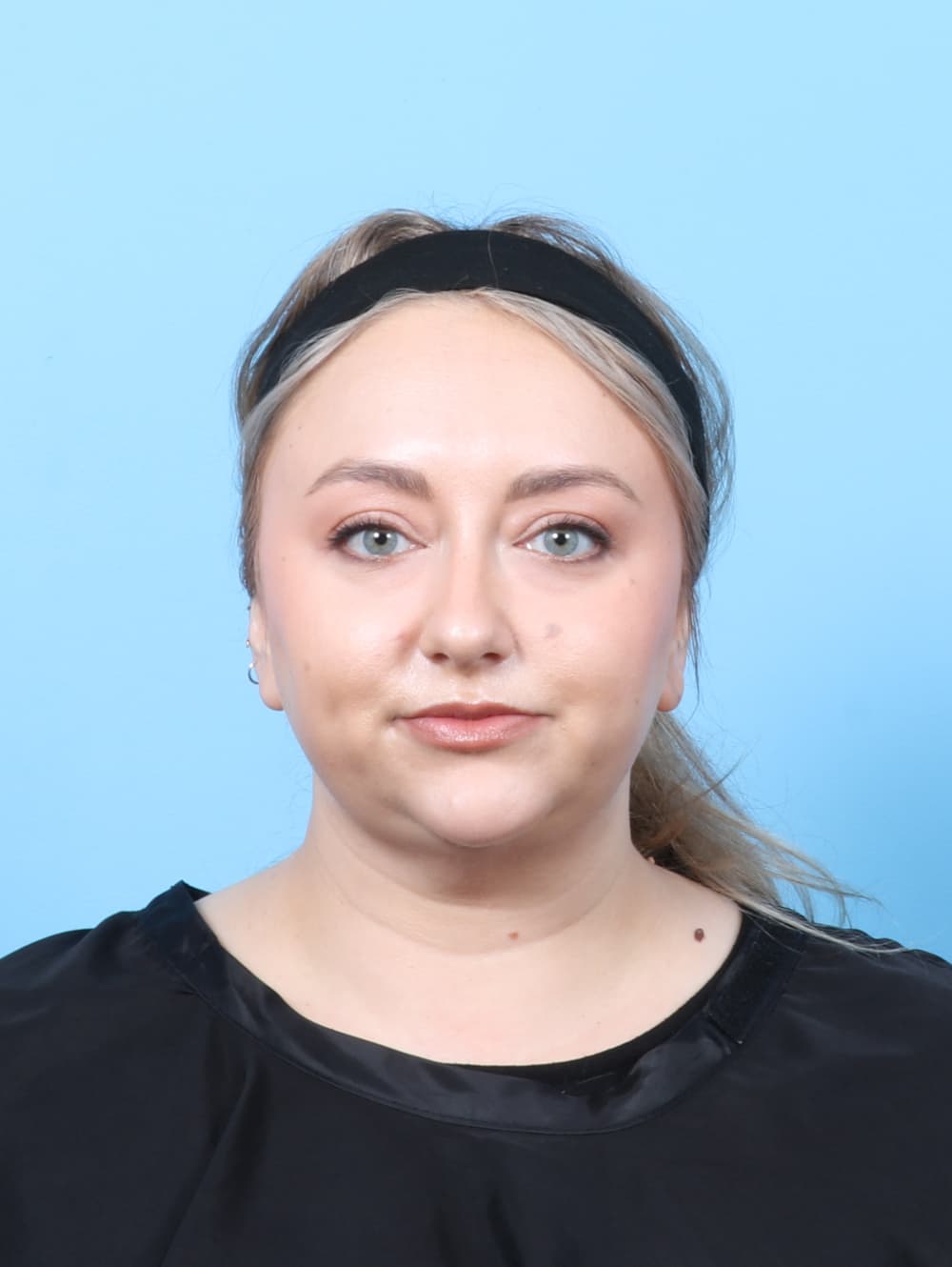 Facial Surgery case #7686 after