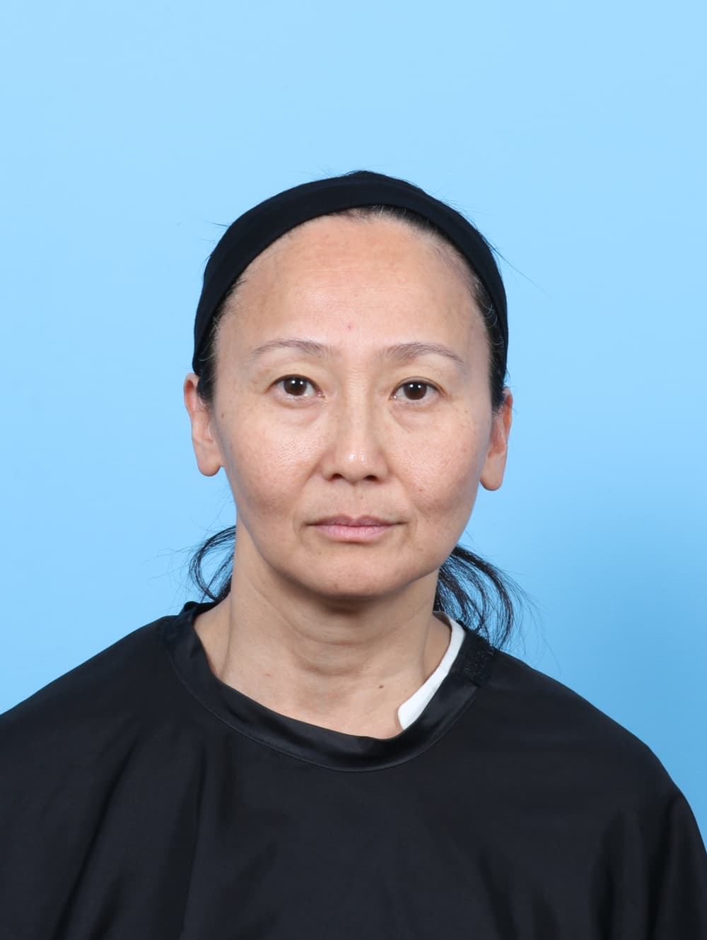 Eyelid Surgery case #7944 before, image 1