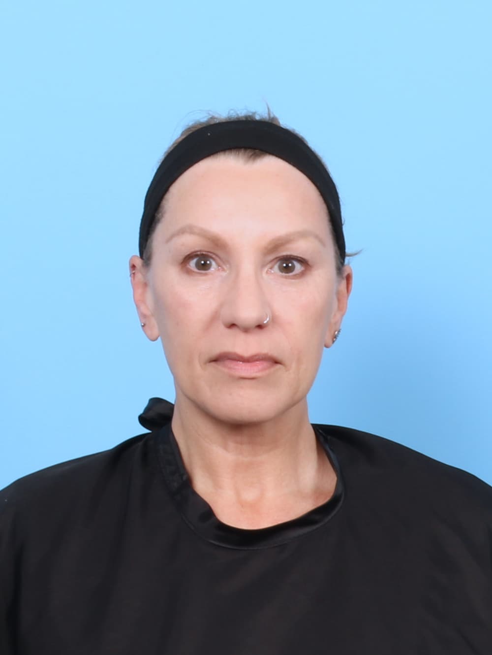 Facial Surgery case #7331 before
