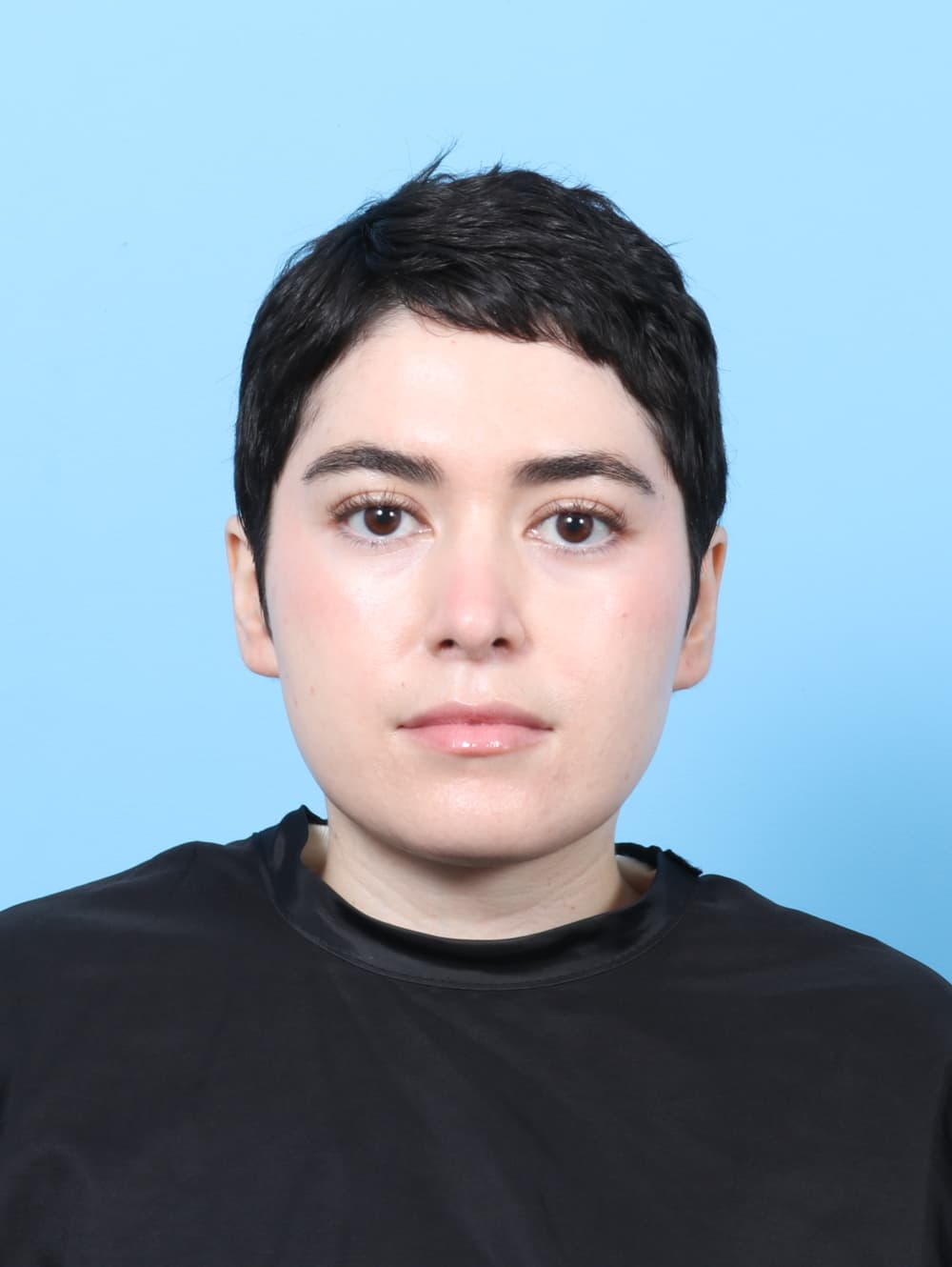 Rhinoplasty case #7668 after, image 2