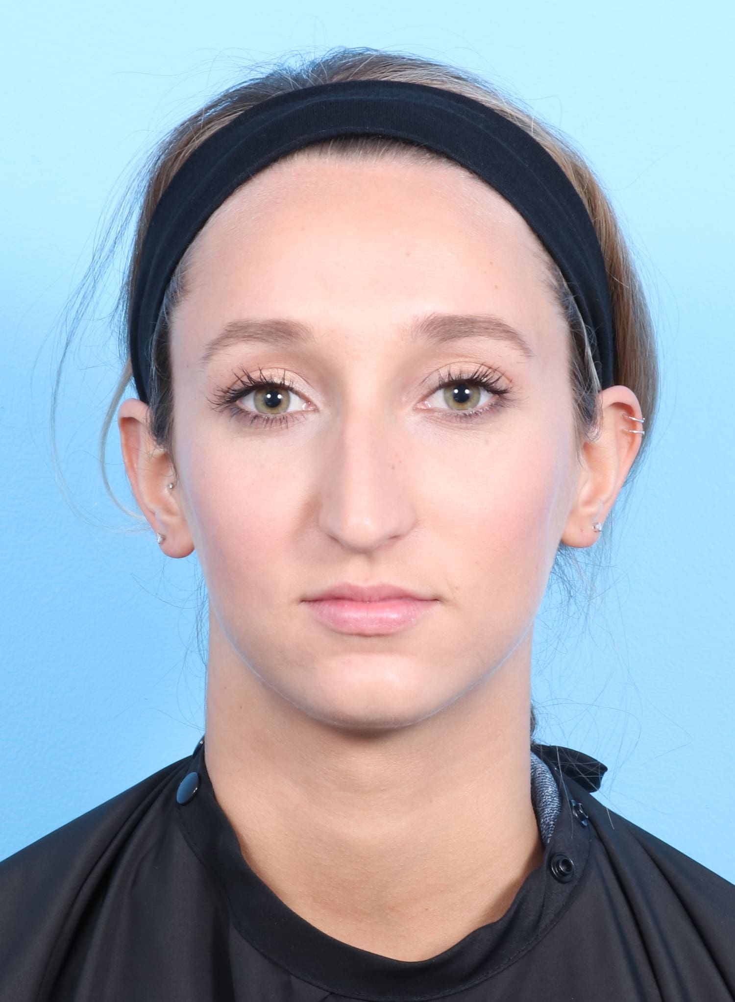 Rhinoplasty Patient Photo - Case 1321 - before view-1