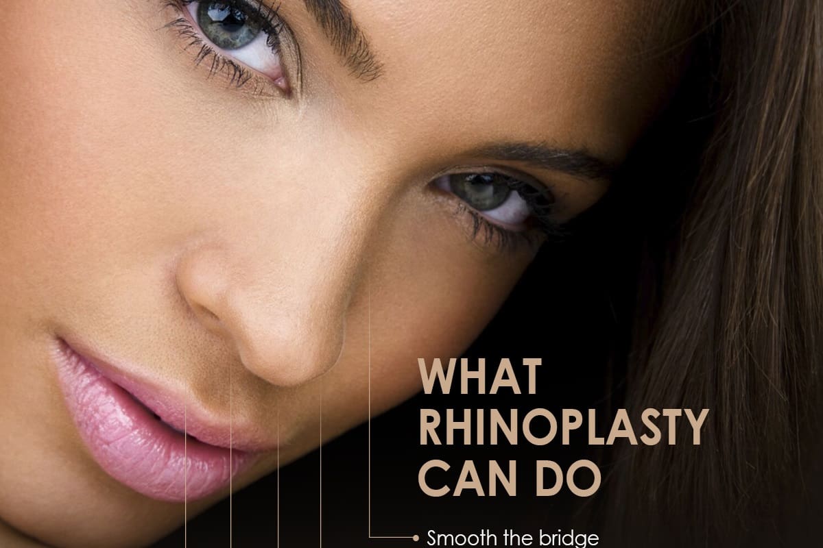What Rhinoplasty Can Do [Infographic]