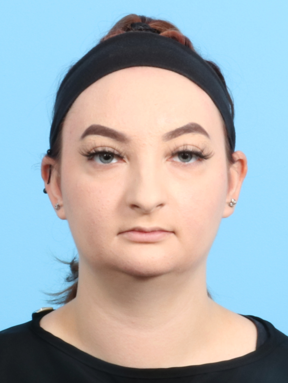 Rhinoplasty Patient Photo - Case 2528 - before view-1