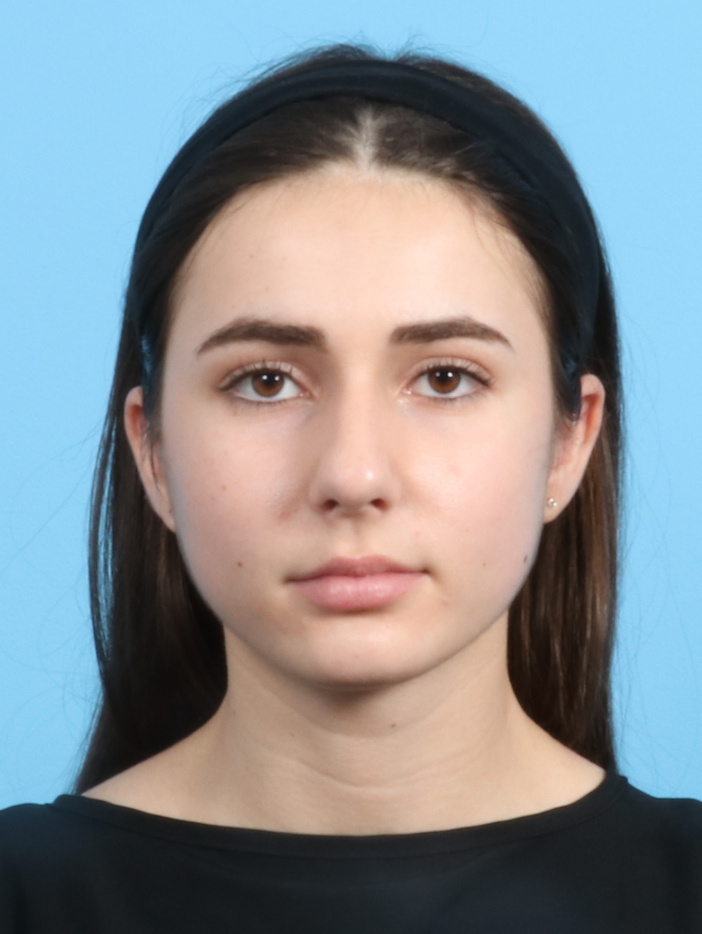 Rhinoplasty Patient Photo - Case 2679 - before view-1