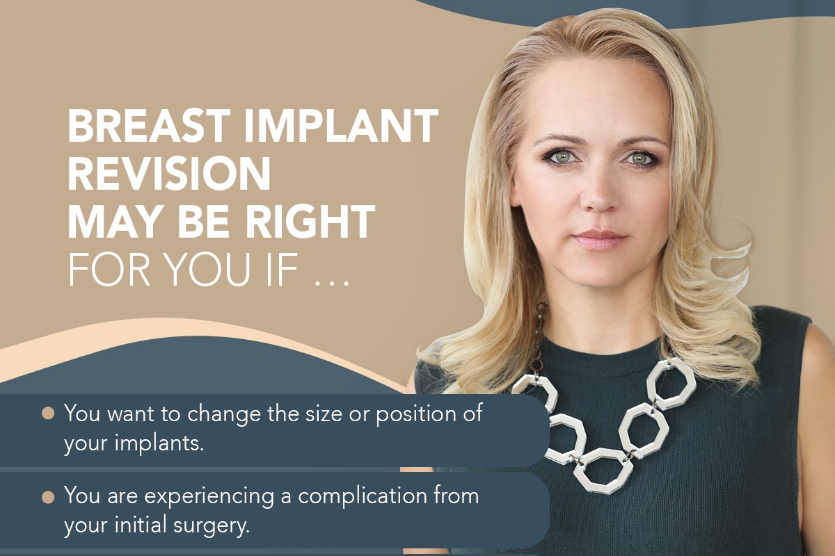 Breast Implant Revision May Be Right For You If... [Infographic]