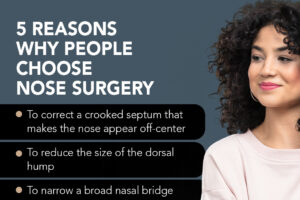 5 Reasons Why People Choose Nose Surgery thumb