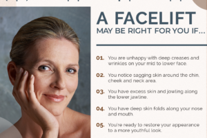 A Facelift May Be Right for You If... thumb