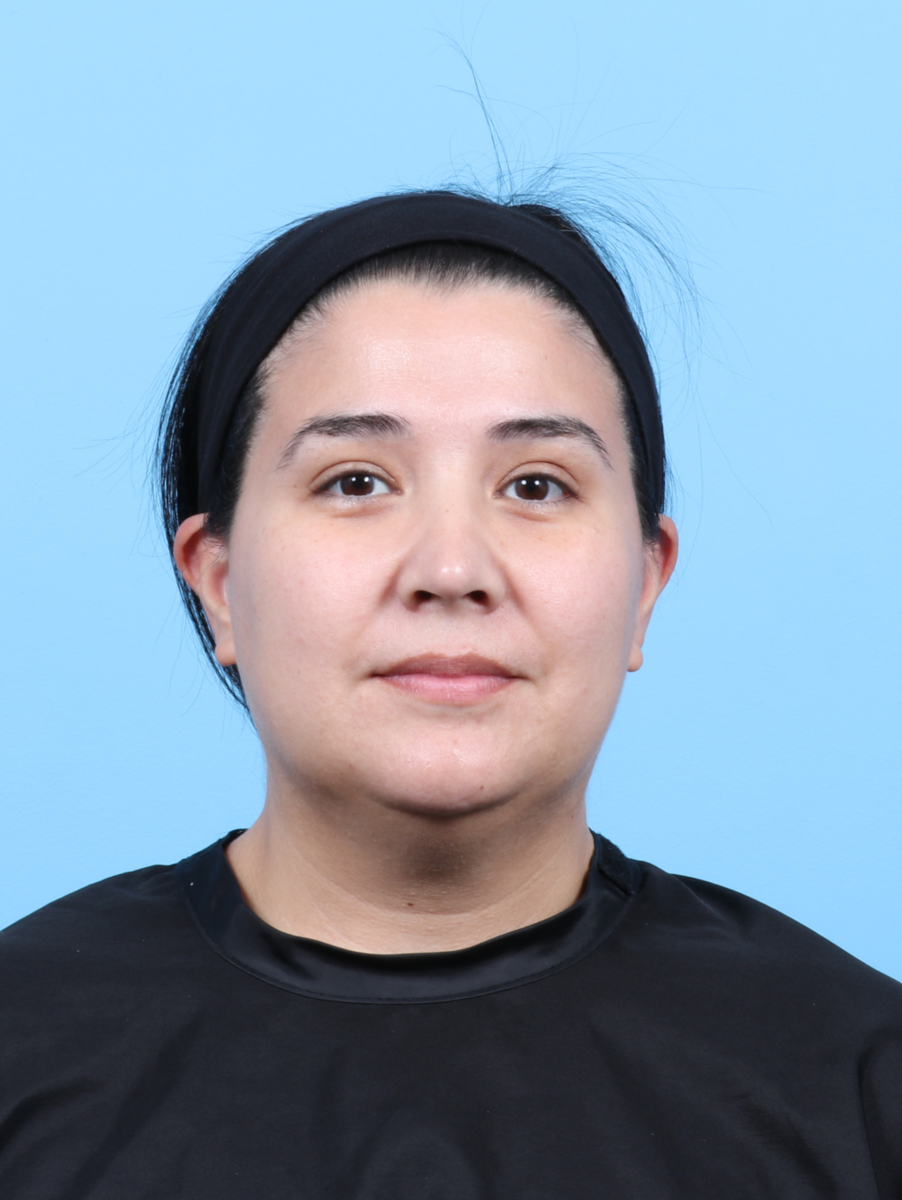 Facial Liposuction Patient Photo - Case 7897 - before view-