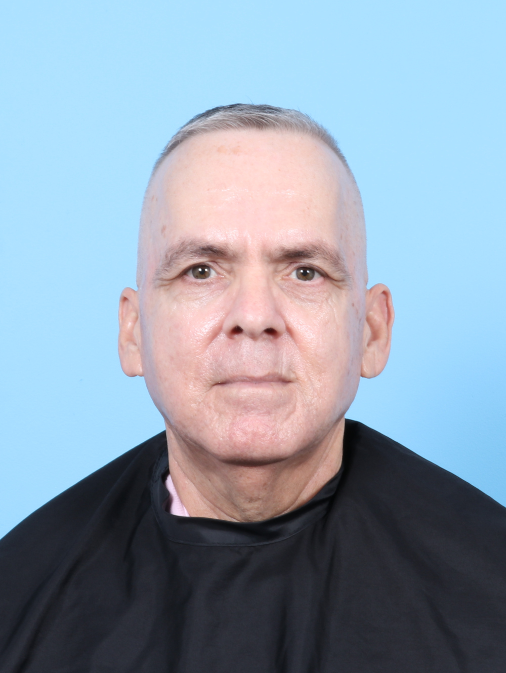 Eyelid Surgery Patient Photo - Case 7915 - before view-