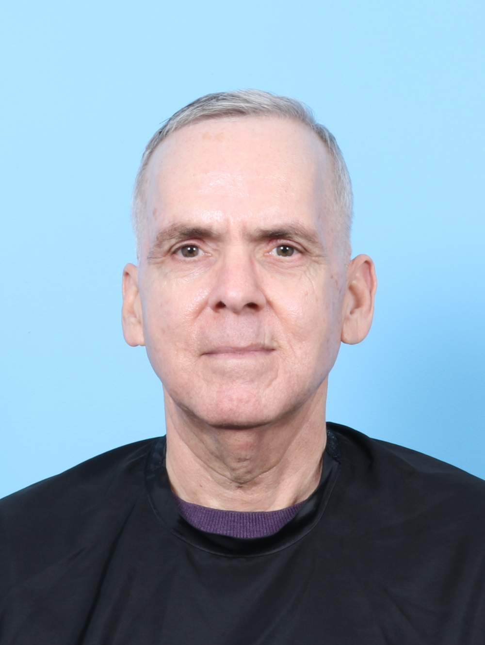 Eyelid Surgery Patient Photo - Case 7915 - after view