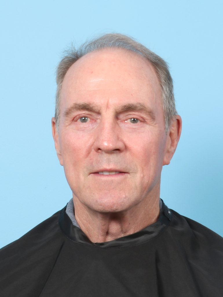 Eyelid Surgery - Case 8187 - After