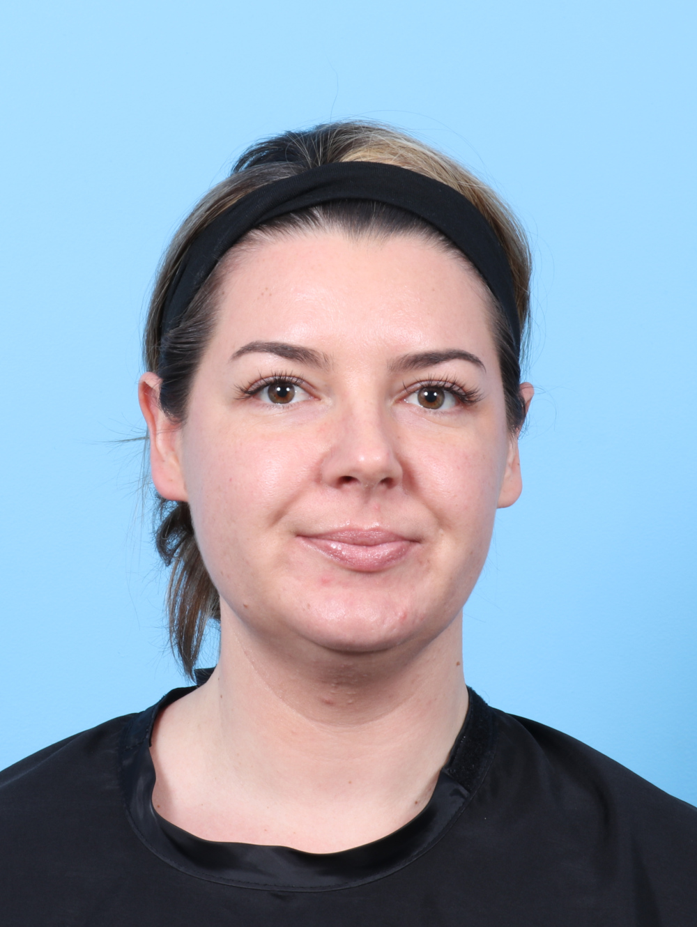 Facial Liposuction Patient Photo - Case 8195 - before view-