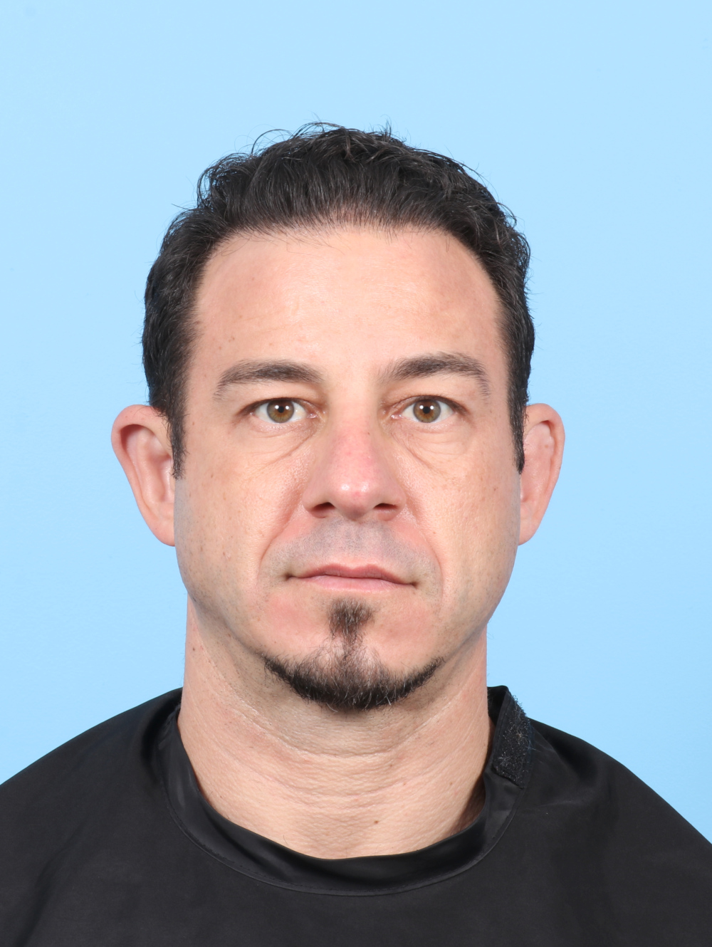 Eyelid Surgery Patient Photo - Case 8386 - before view-